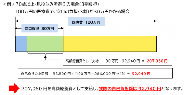 高額療養費の計算例